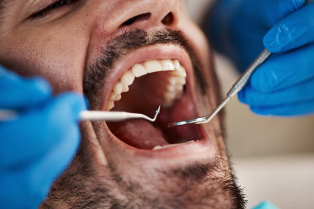 Best Broken Tooth Emergency  in Grove City, FL